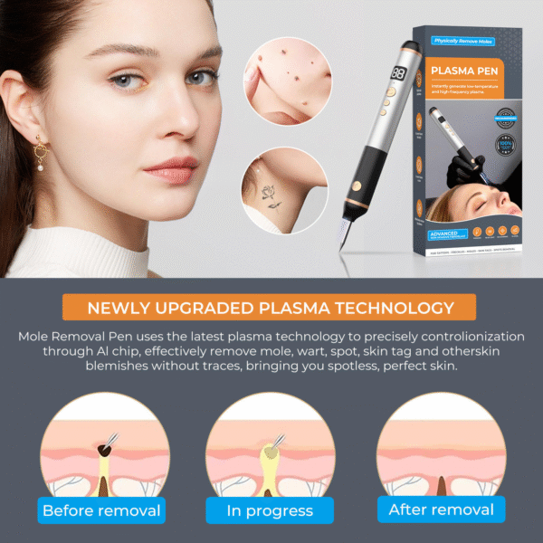 15-Level Plasma Pen Painless Skin Tag Mole & Wart Remover