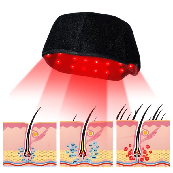 Portable Hair Pro 660nm 850nm Red Light Therapy Hair Growth Hat Hair Regrowth Laser Growth Laser Cap for Home Use