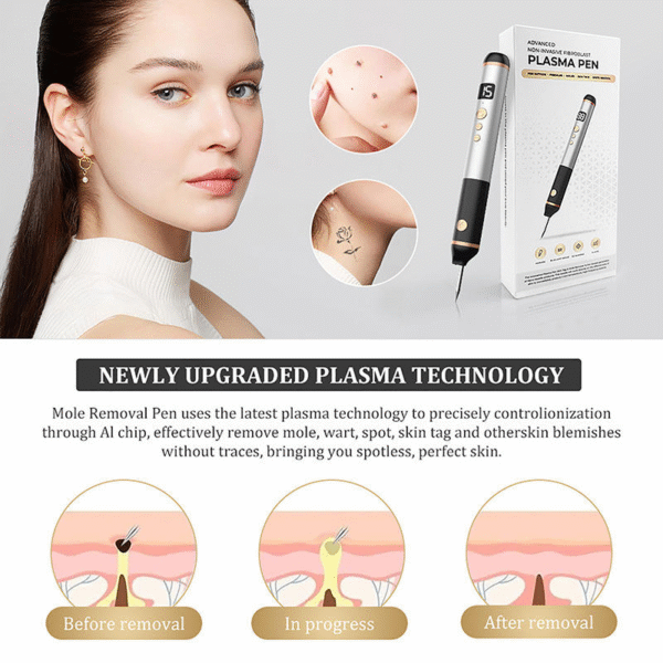 15-Level Plasma Pen Painless Skin Tag Mole & Wart Remover