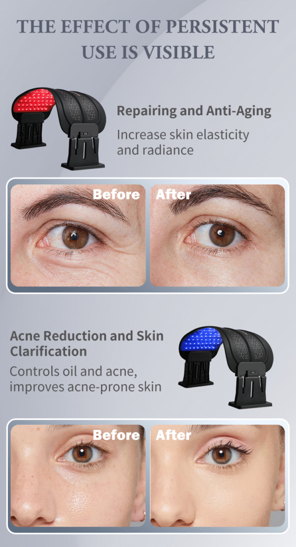 Standing Red Near Infrared LED Light Therapy Lamp for Face amp Body PDT Machine 660Nm 850Nm Home Use