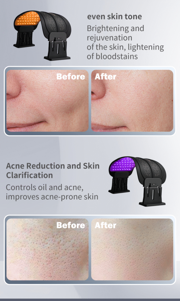 Standing Red Near Infrared LED Light Therapy Lamp for Face amp Body PDT Machine 660Nm 850Nm Home Use