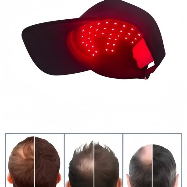 56-LED Hair Growth Cap | Red Blue Light Therapy Type-C Rechargeable